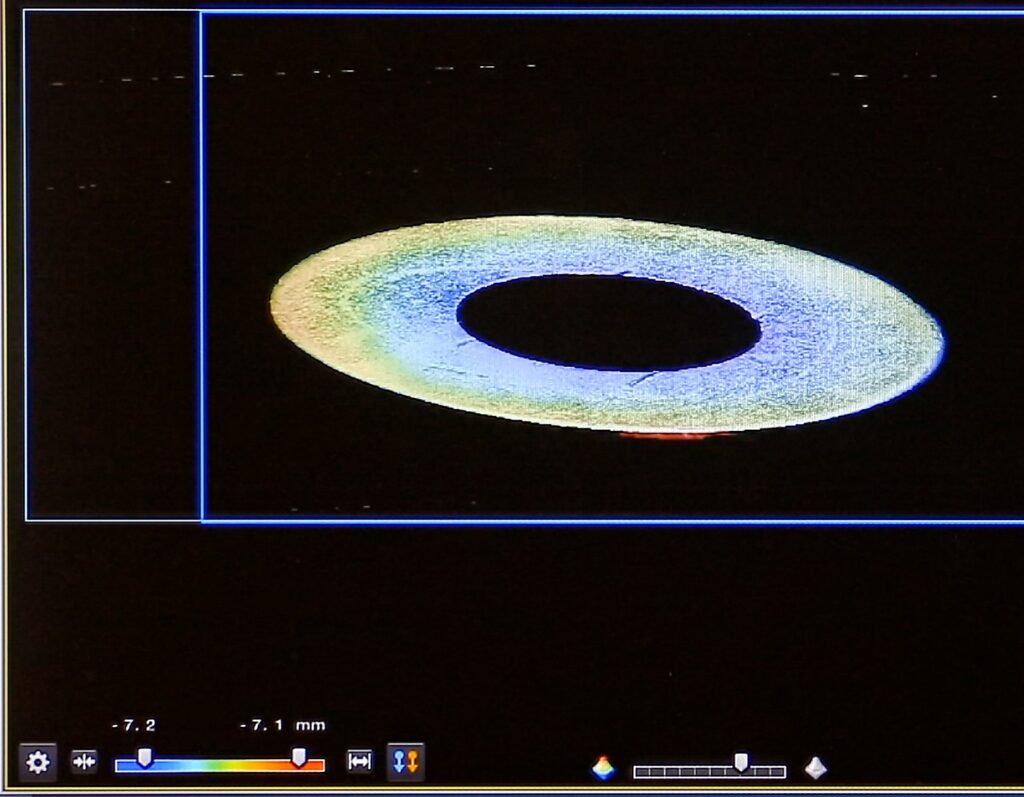 3D-Höhenprofil eines Rings – erfasst per Lasertriangulationssensor